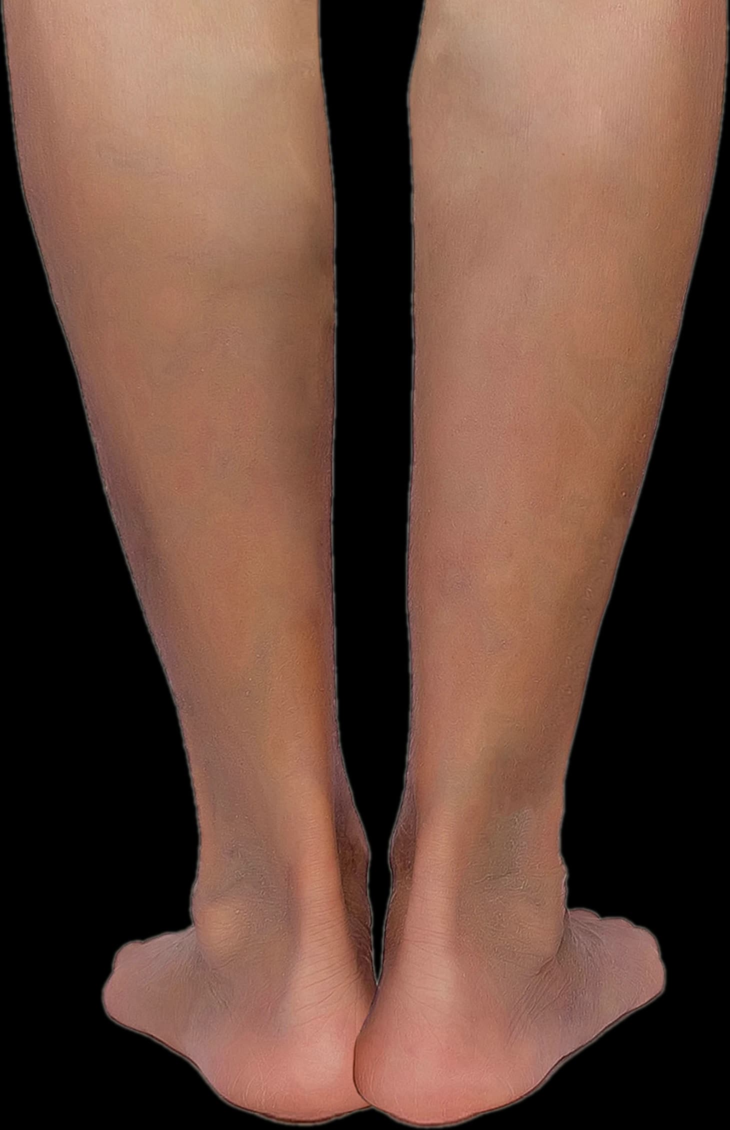 Backs of both lower legs and ankles with clear skin and no visible surface veins